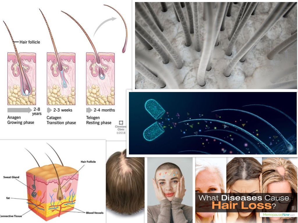 hair loss among women